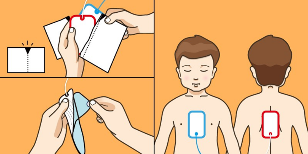 A Complete Guide to Using Pediatric AED Pads Mindray